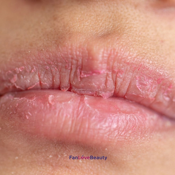 7 Benefits of Using a Lip Balm